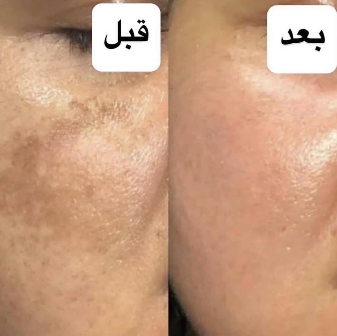 نتائج حقيقية من الصالون.